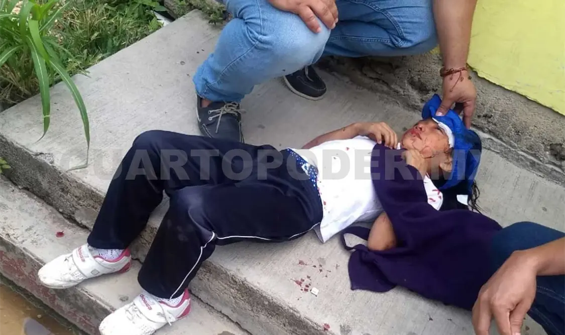 La pequeña intentaba cruzar la calle al momento de ser arrollada por el sedán, quedando seriamente lesionada. Edberg Mayorga / CP