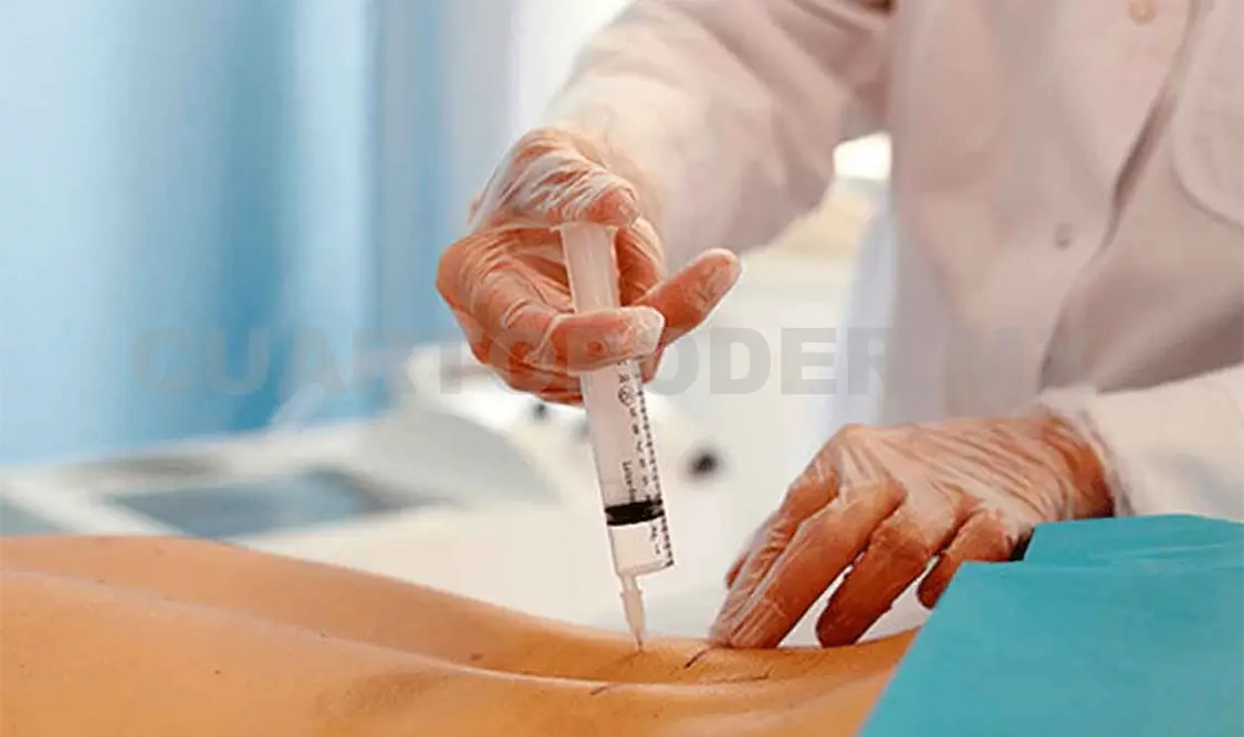Ozonoterapia, innovación médica en Chiapas
