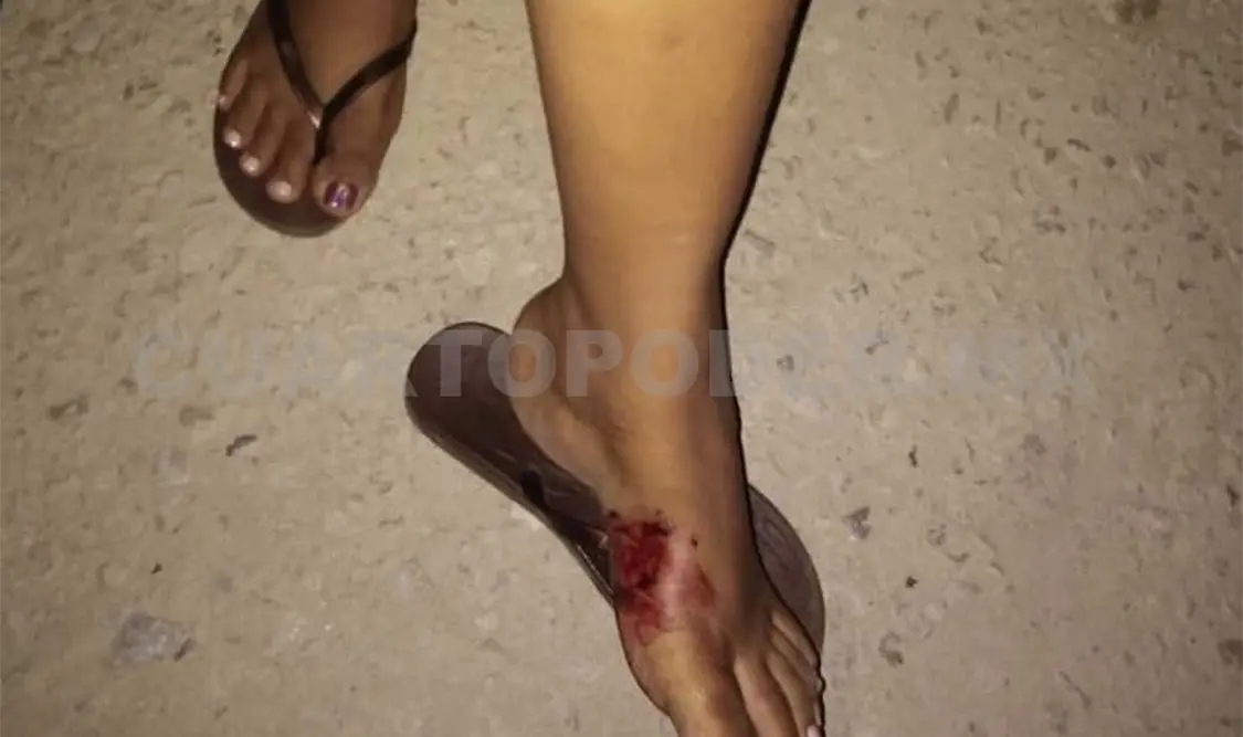 Septuagenario hirió de rozón de bala a mujer