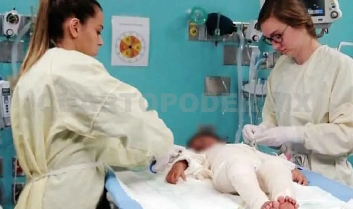 DIF traslada a niña con quemaduras
