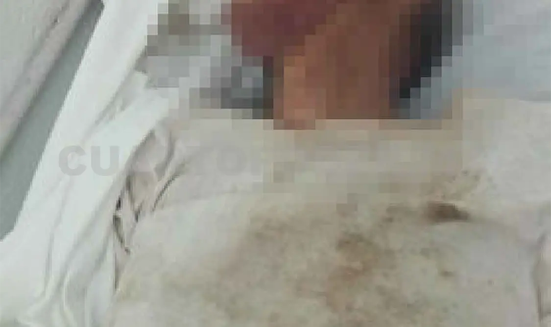 Muere abuelito tras caer a pozo artesiano