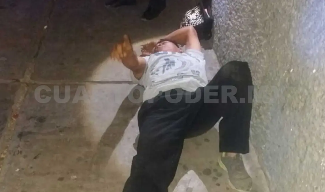 Niño cae de su bicicleta y termina fracturado