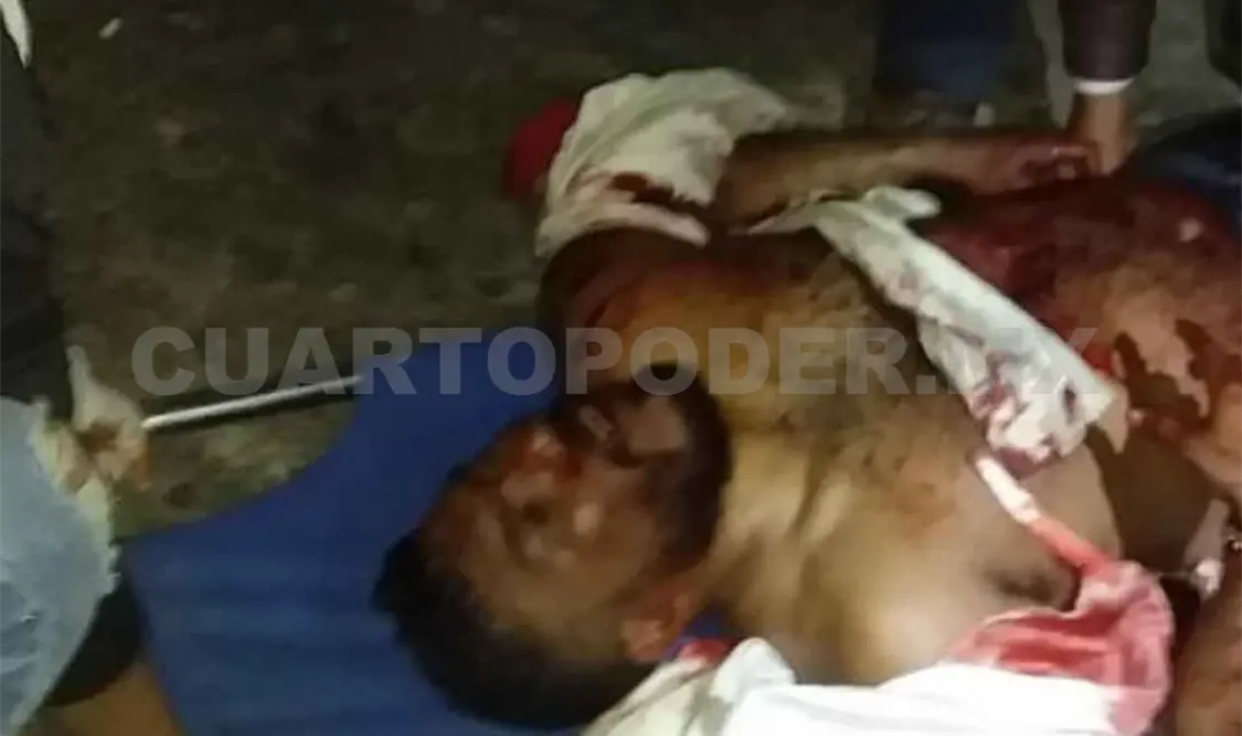 Lo balean en riña y queda grave