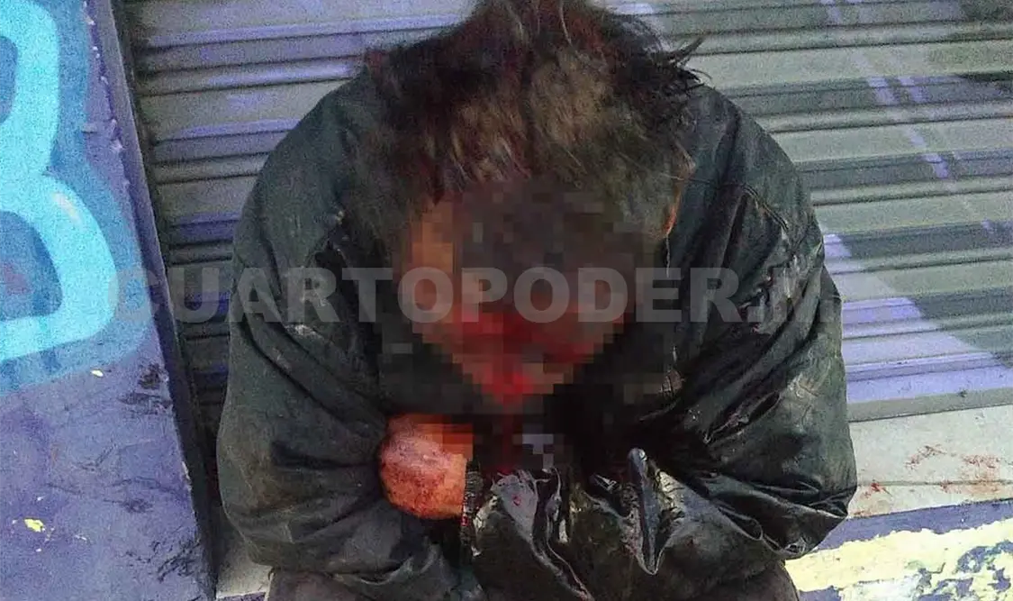 Septuagenario lesionado: se presume riña