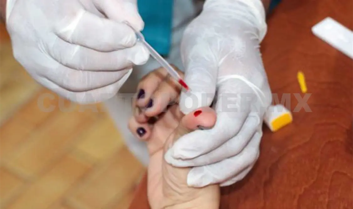 La detección a tiempo es vital para tratar dicha enfermedad. Cortesía