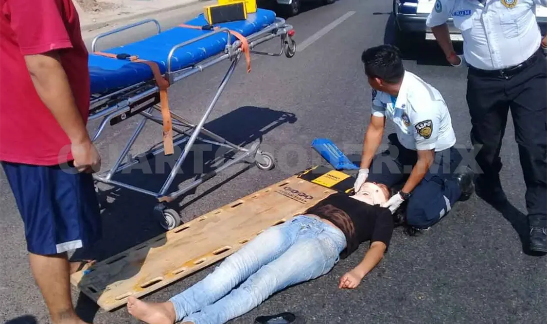 Perdió la dentadura tras ser arrollada por Ranger