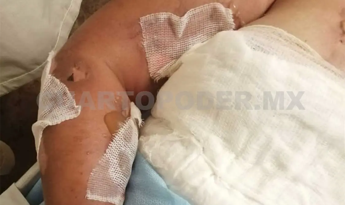 Las policías de Tránsito fueron agredidas la noche del 25 de marzo en la capital chiapaneca; permanecen hospitalizadas. Cortesía