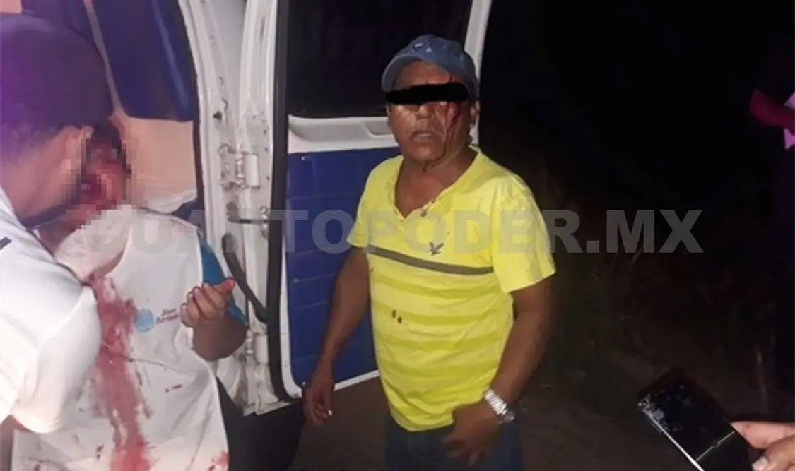 Chocan contra llanta y resultan malheridos