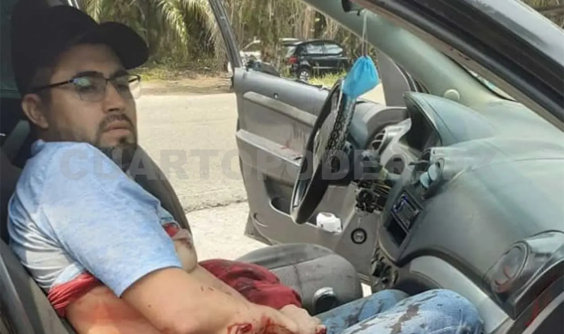El ganadero de nombre Homero “N” resultó con impactos de arma de fuego en el cuerpo y fue trasladado a un hospital. Genaro Sánchez / CP