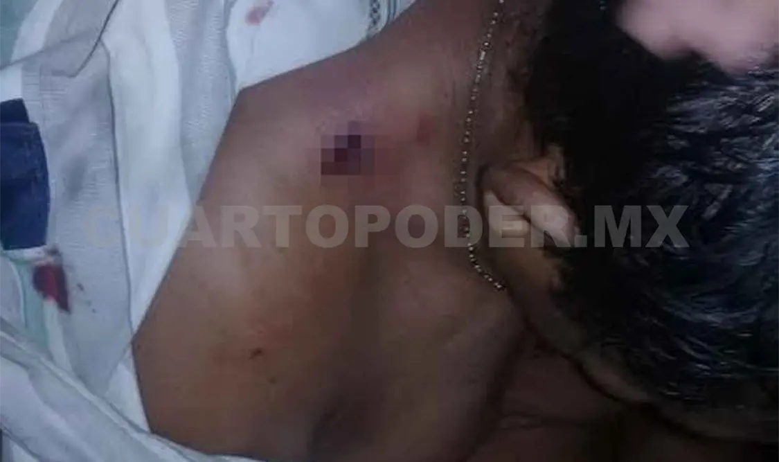 Hiere de tres balazos a su suegro y huye