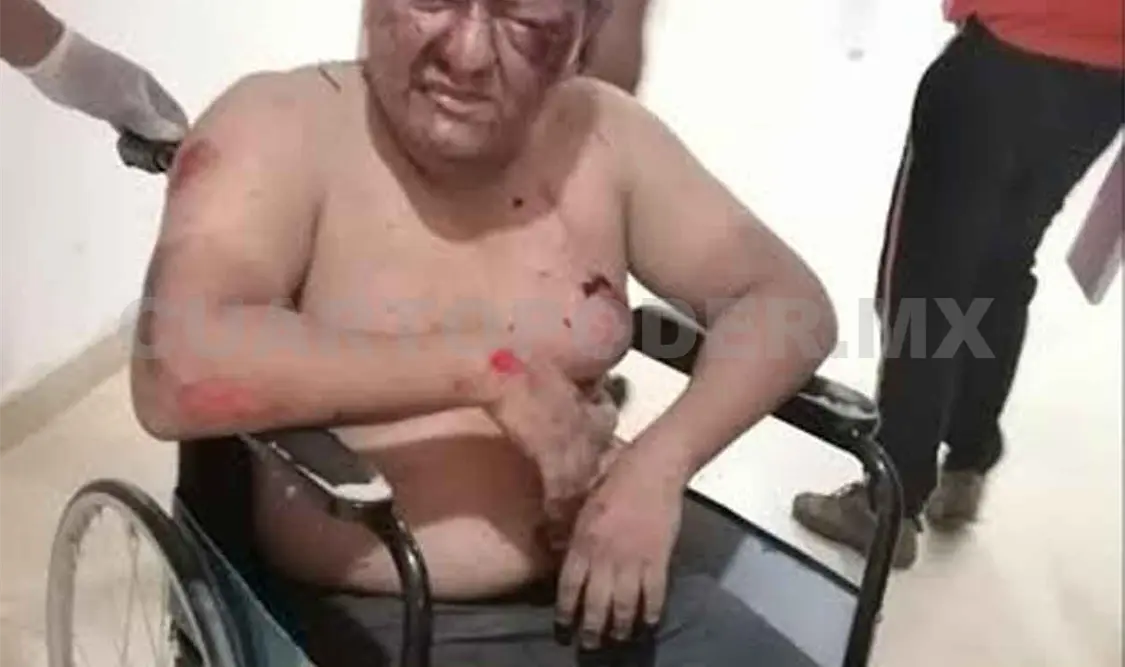 Motociclista fue arrollado por vehículo “fantasma”