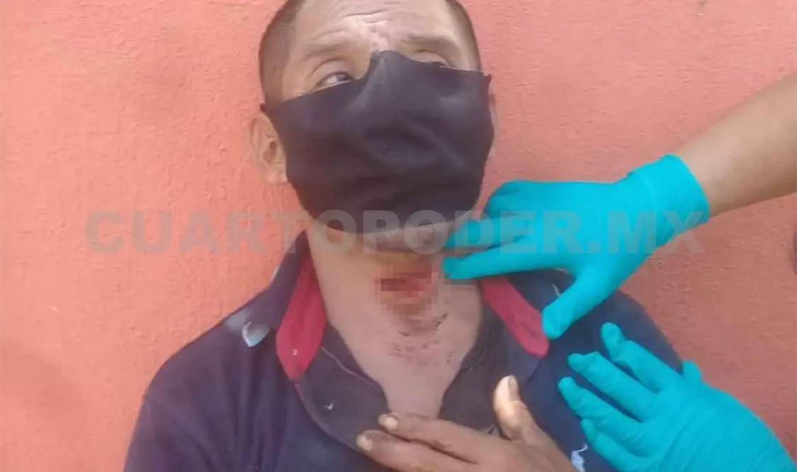Lo machetean en el cuello para robarle 20 mil pesos