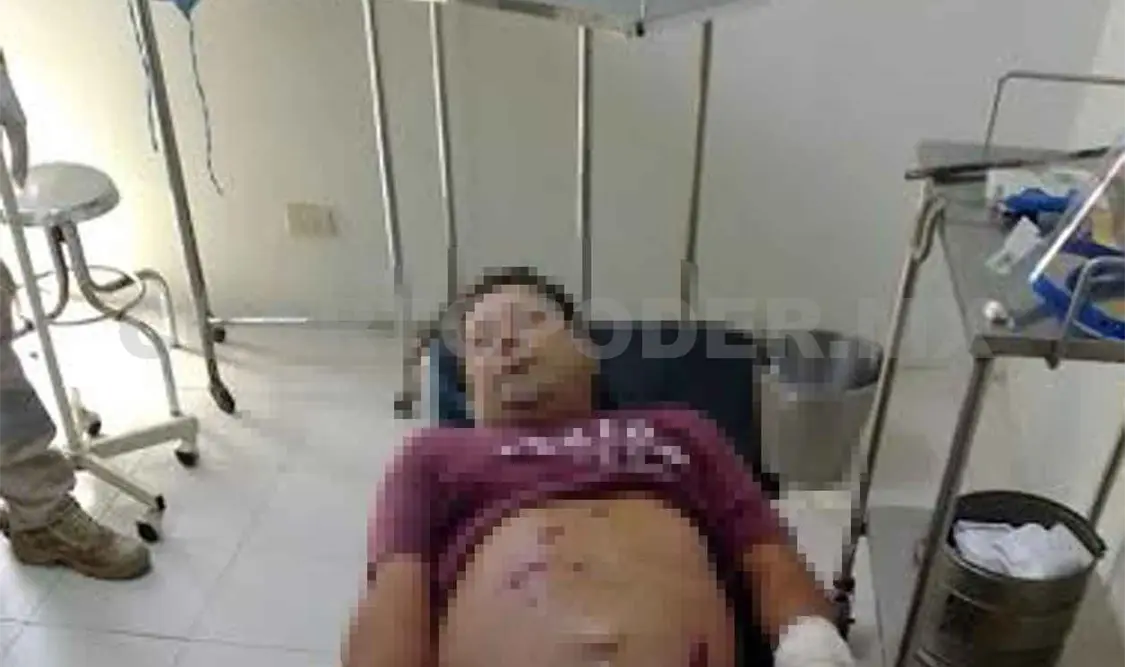 Peruano, dueño de un bar, fue baleado