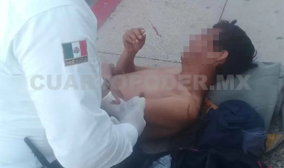 Lo asaltan y le propinan golpiza