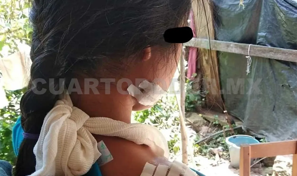 Menor lesionada de Aldama es dada de alta