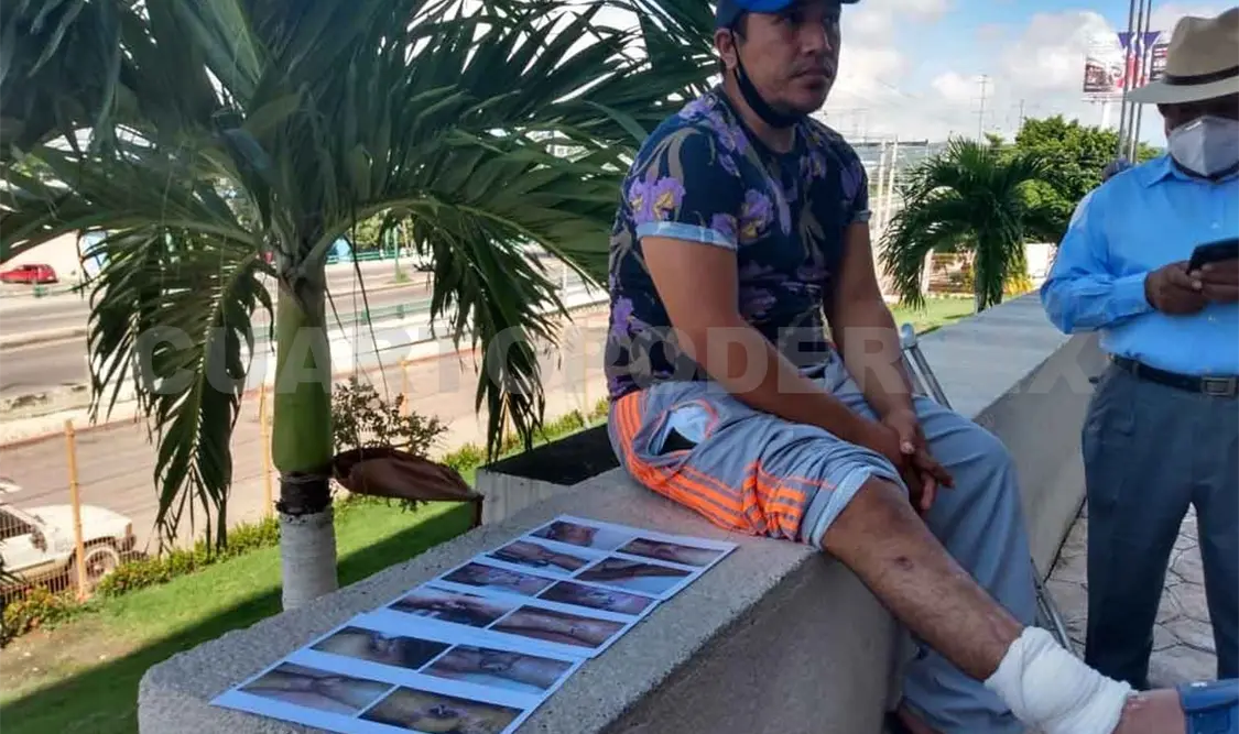 Joven arrollado por unidad exige justicia