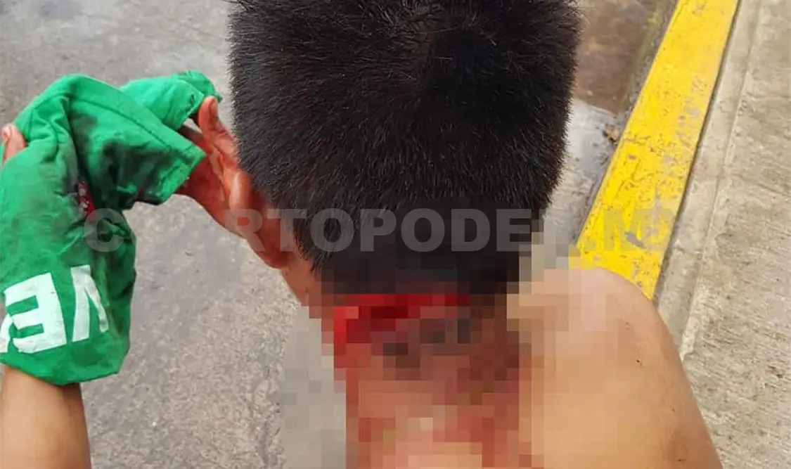 Riña entre catrachos salda con un herido