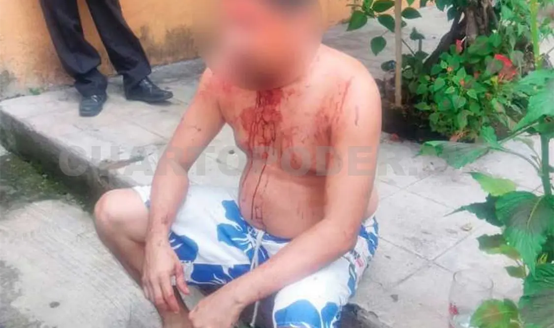 Con una herida en la cabeza y golpes en el cuerpo terminó un mecánico durante una violenta riña callejera. CP