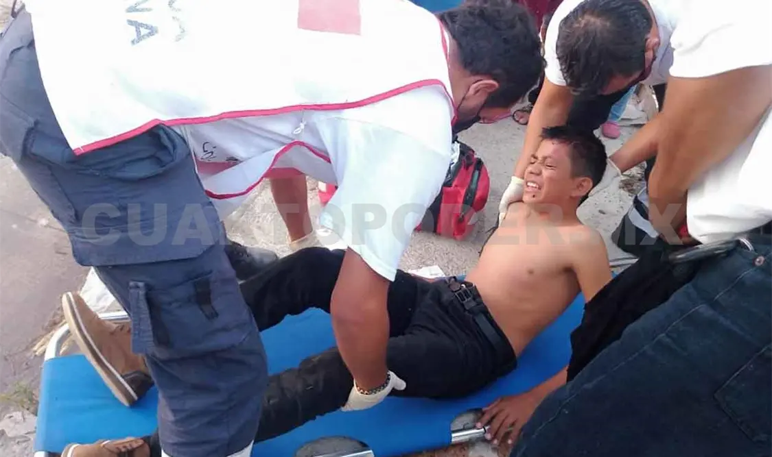 Joven queda herido de la cabeza en accidente