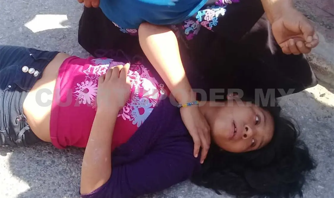 Con múltiples lesiones en el cuerpo quedó la pequeña Fabiola, luego de ser atropellada cuando intentaba cruzar la calle. Moisés Lorenzo / CP