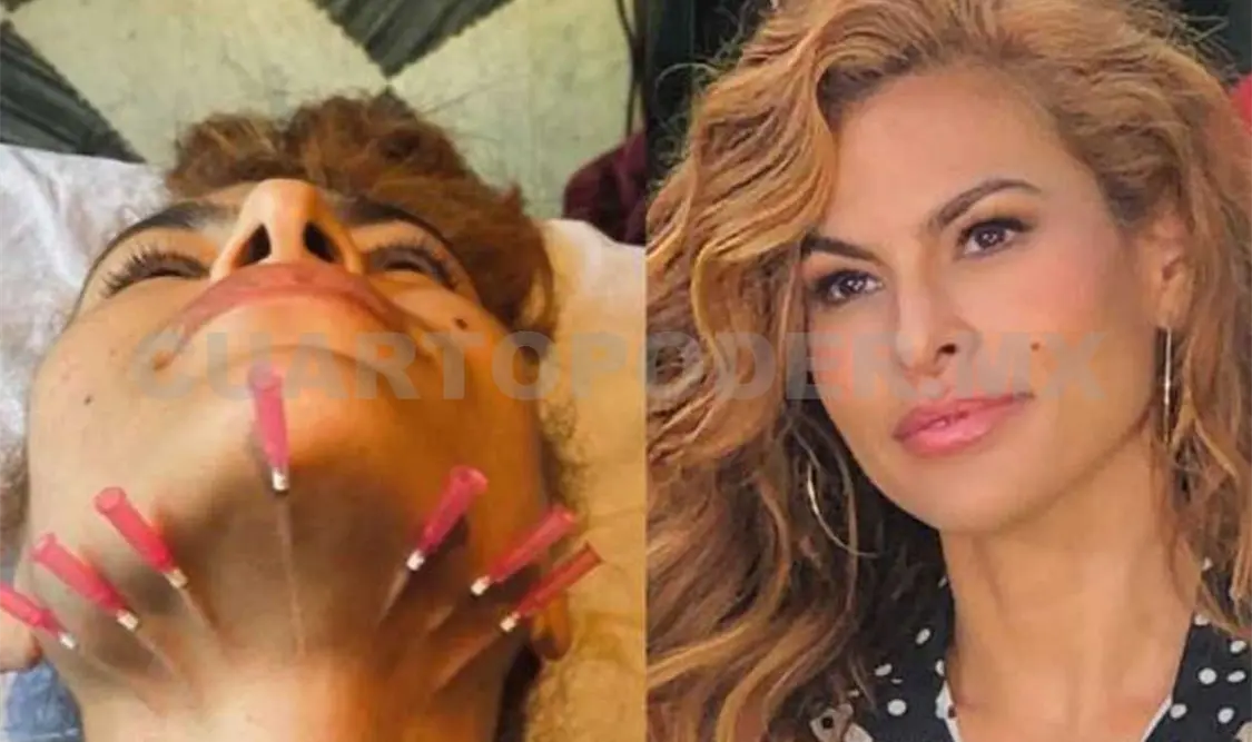 Eva Mendes y su cuello perforado por agujas