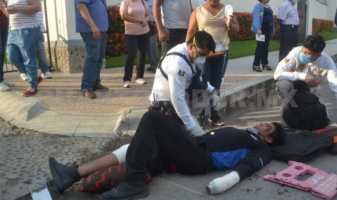 Con la pierna derecha y la mano izquierda rota, además de una herida en el rostro, fue como terminó el repartidor de pizzas en el accidente. Ulises López / CP