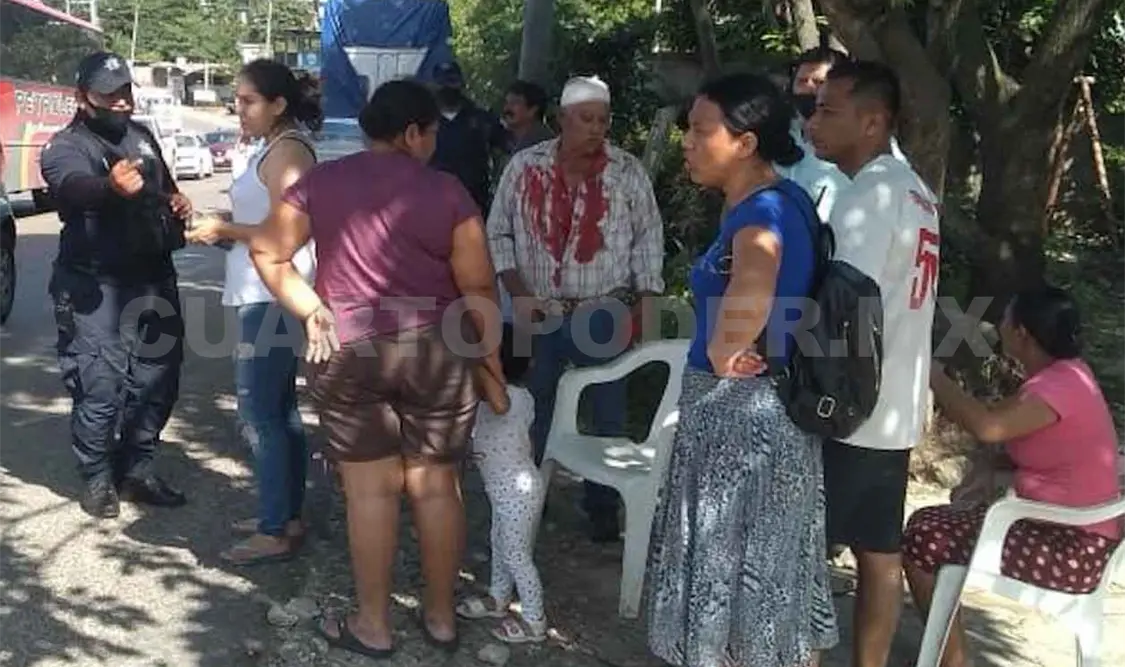 Exalcade sufre fuerte accidente en periférico