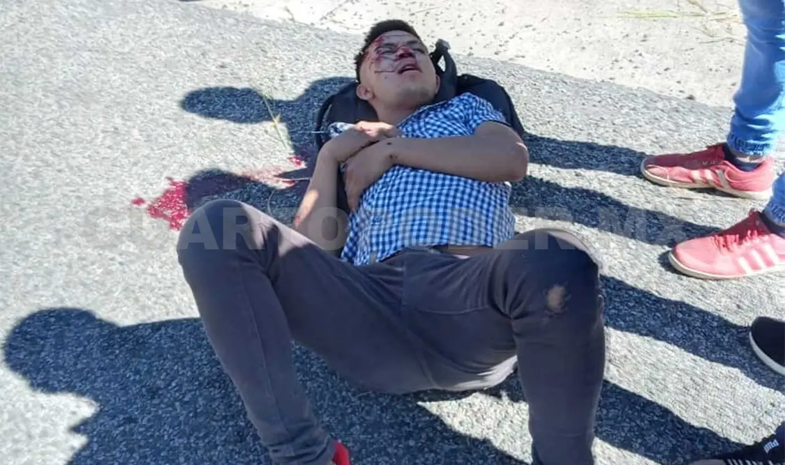 Muere mujer en derrape de moto