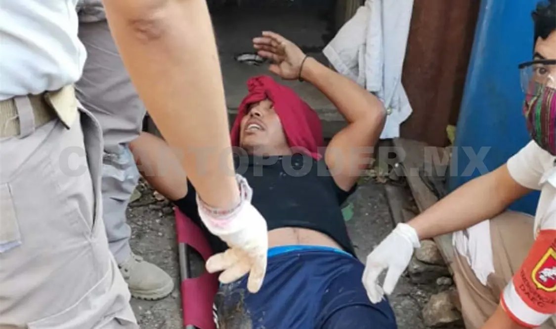 Humberto Bernal Núñez resultó con un impacto de arma de fuego en la pierna y fue trasladado por paramédicos a un hospital. Ulises López / CP