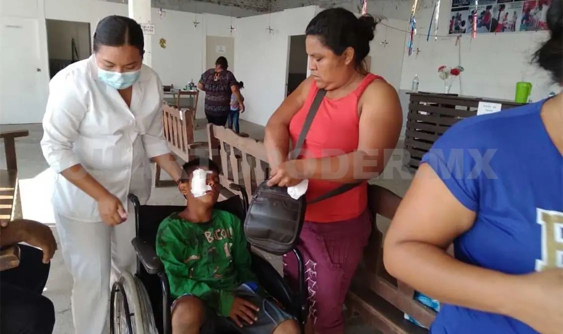 Niño casi pierde un ojo al ser atacado por un perro
