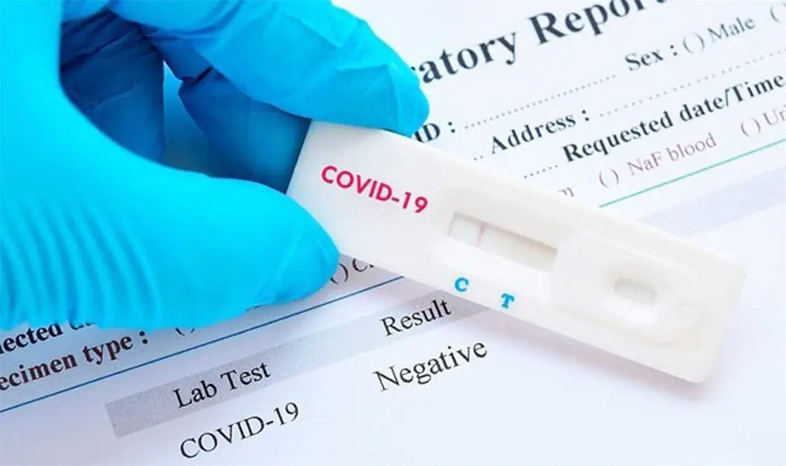 Anticuerpos por covid durarían sólo 2 o 3 meses