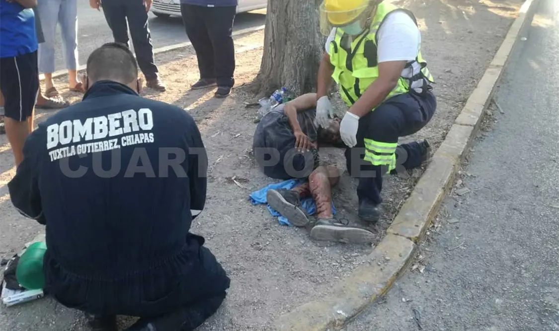 Le pasan las llantas encima y termina en un hospital