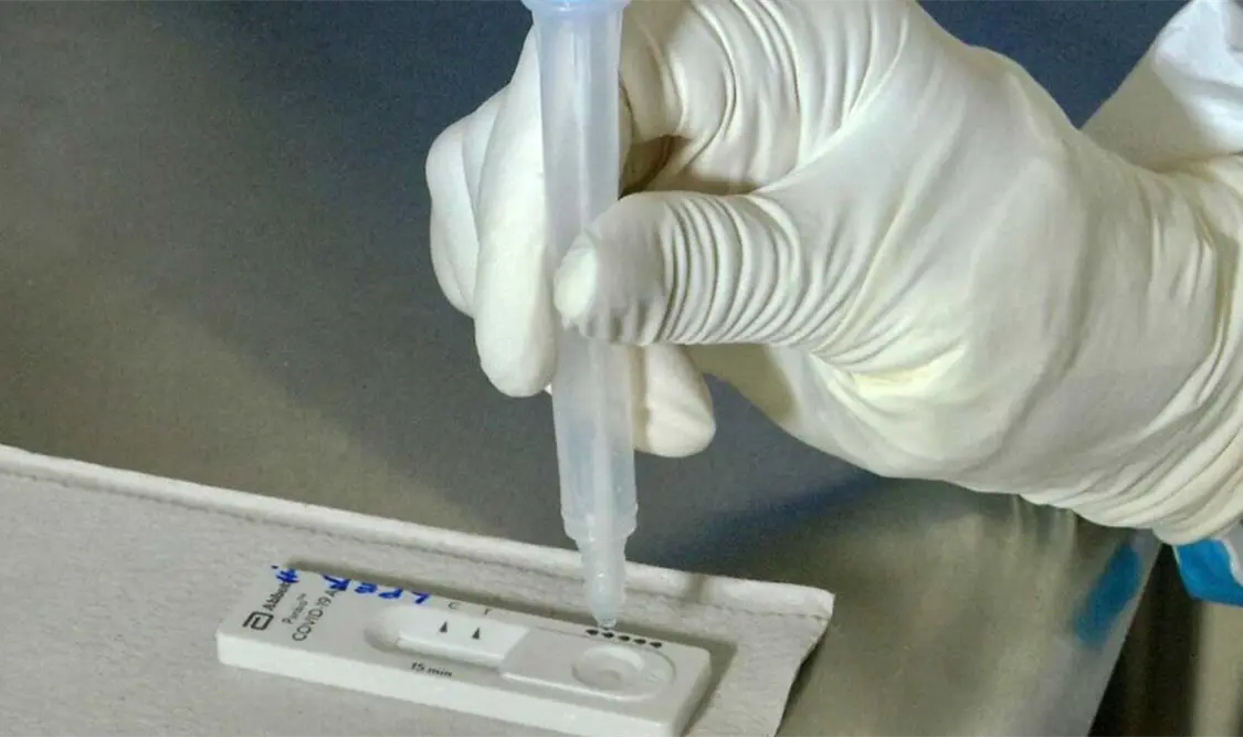 El test no debe tener más de 72 horas de expedición por laboratorio. Cortesía