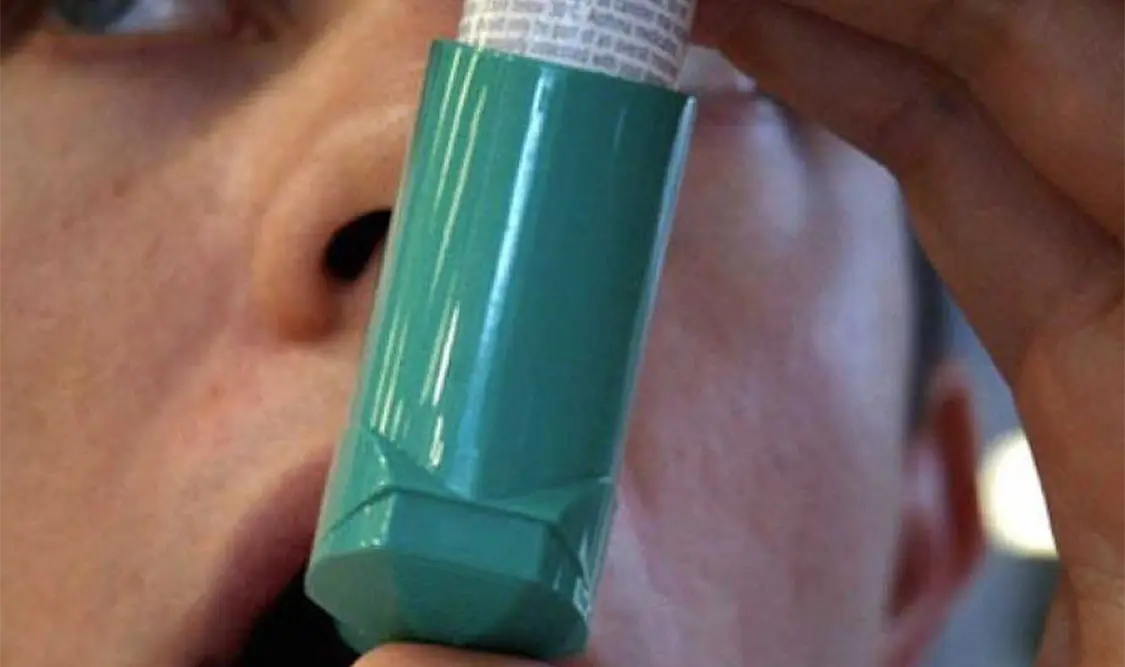 Se recomienda atenderse con un especialista y no automedicarse. Cortesía