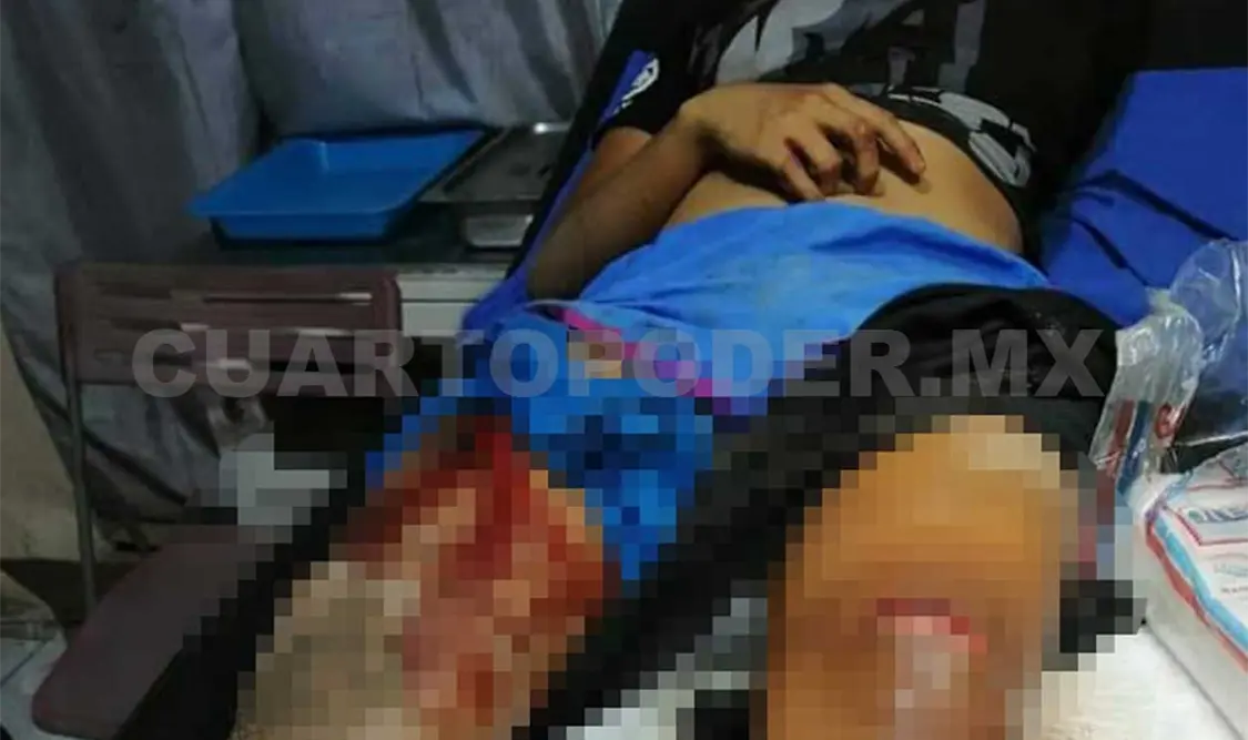 Intenta abusar de menor; además la macheteó
