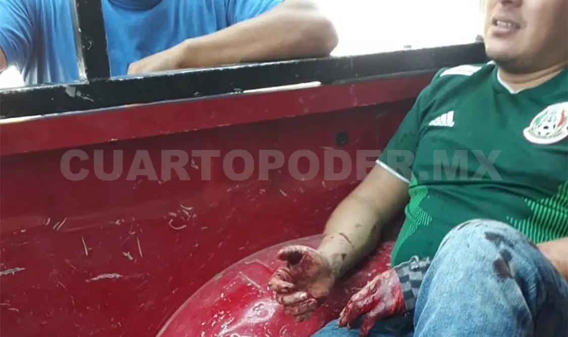 Pitbull ataca a su dueño y casi le despedaza el brazo