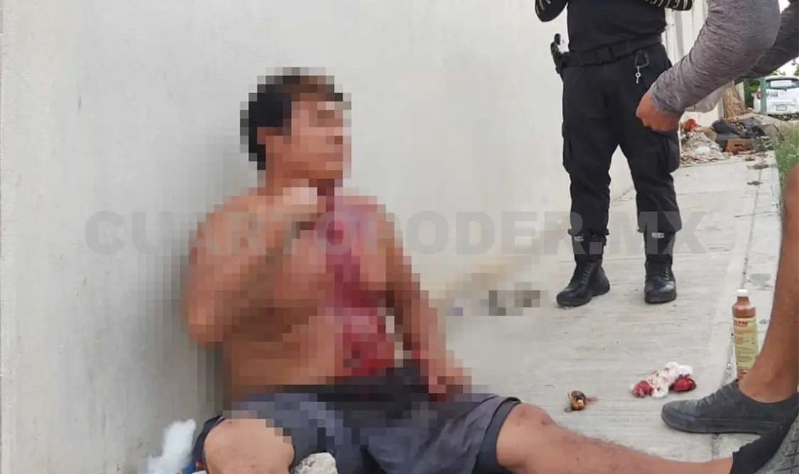 Su hijastro lo macheteó durante violenta riña