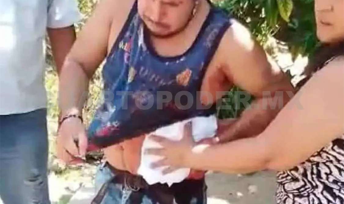 Recibió tres cuchilladas en riña callejera