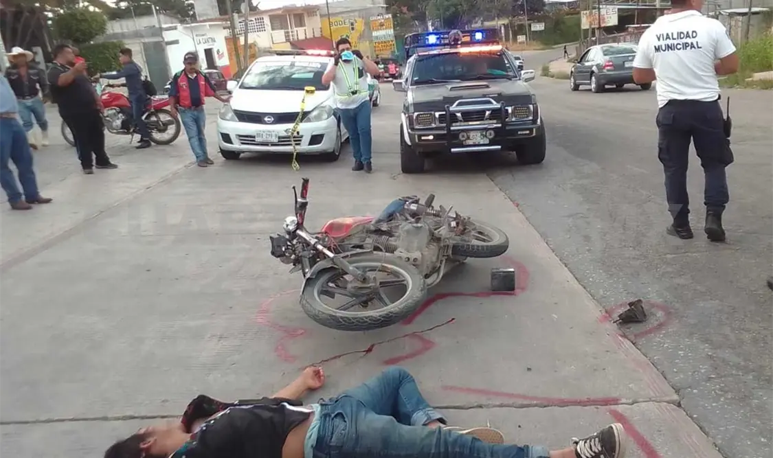 Motociclista resulta gravemente herido en carretera