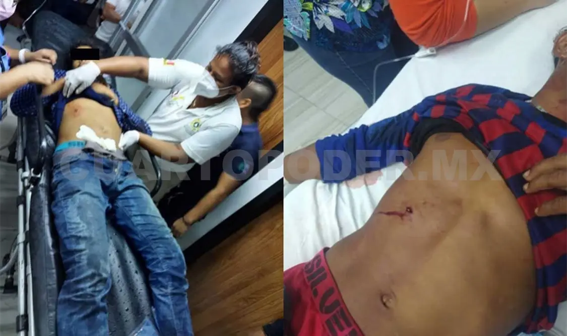 La agresión ocurrió en las inmediaciones de la estación del ferrocarril en el municipio fronterizo durante las últimas horas. Víctor Sánchez / CP