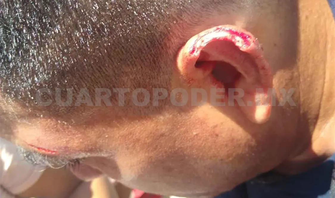 Arrancan parte de la oreja a comandante