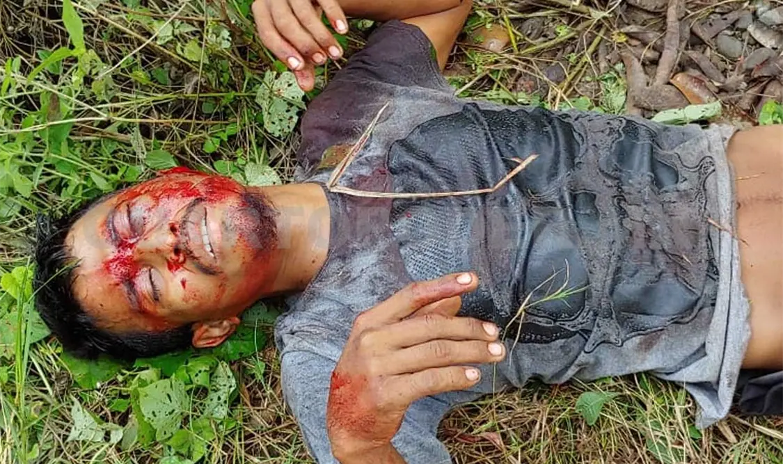 En la riña, uno de los rijosos sacó un arma que hirió de gravedad a Daniel “N”. Víctor Sánchez / CP