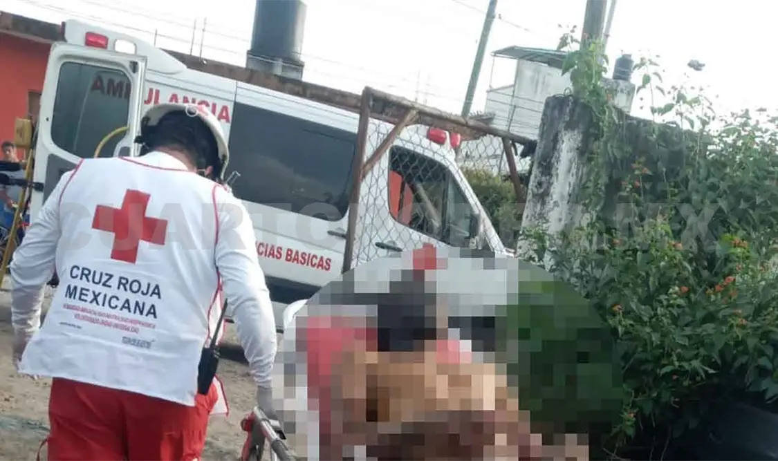 Se prende fuego y muere en hospital
