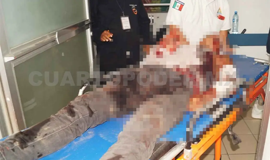 Jovencito es atacado a machetazos en riña