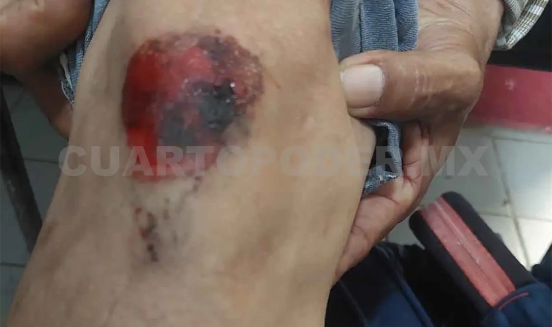Migrantes ambulantes agreden a inspectores