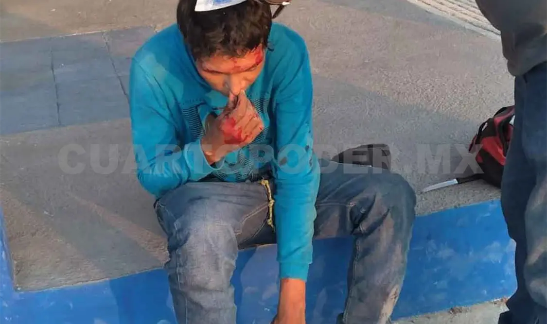 Motociclista derrapa y termina con lesiones