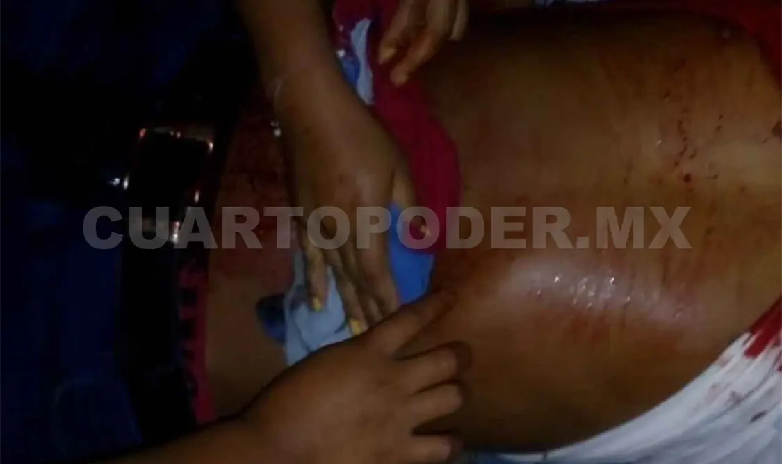 Joven es atacado a cuchilladas por vecino