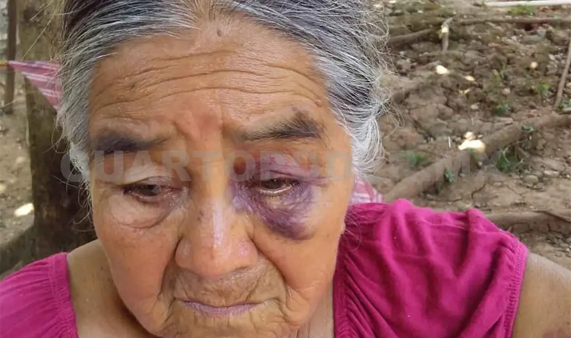 Presuntamente mujer es golpeada por su nuera