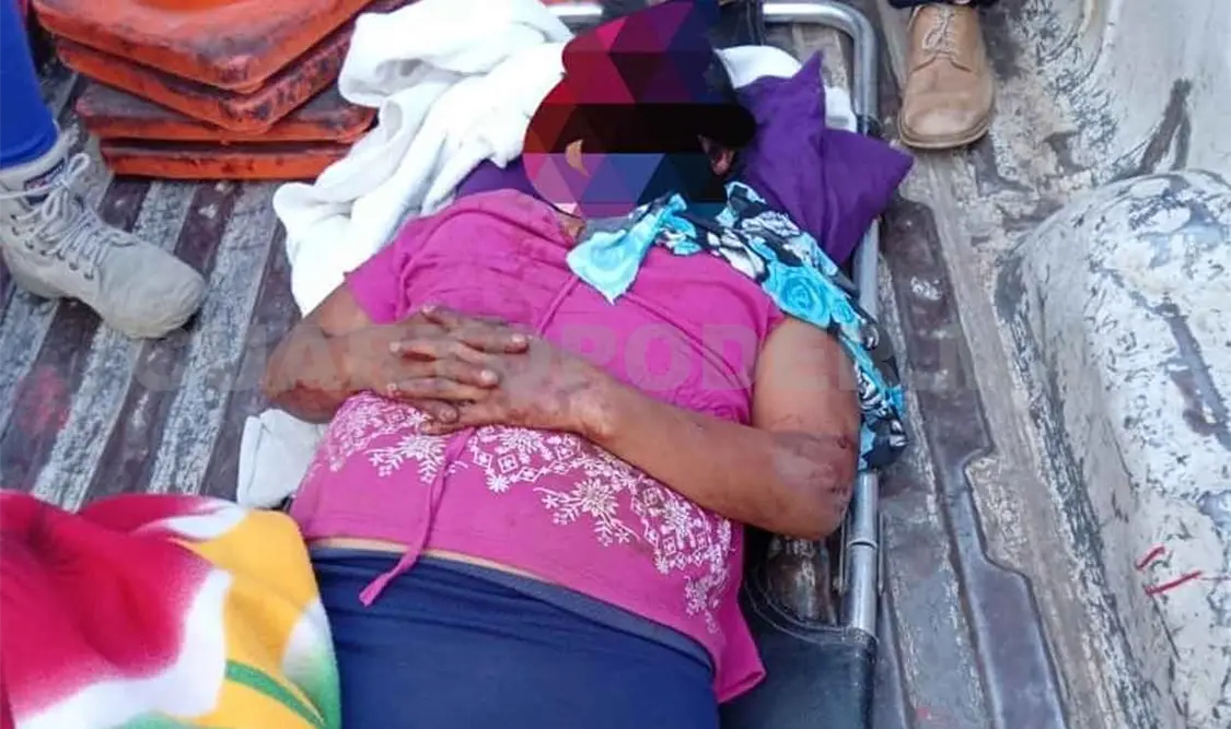 Mujer atacada a machetazos por su pareja está grave