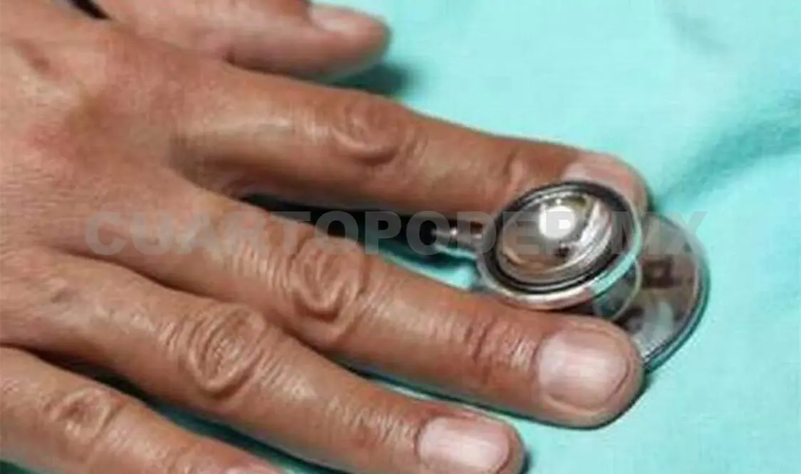 Los especialistas apoyan en este proceso de salud. CP